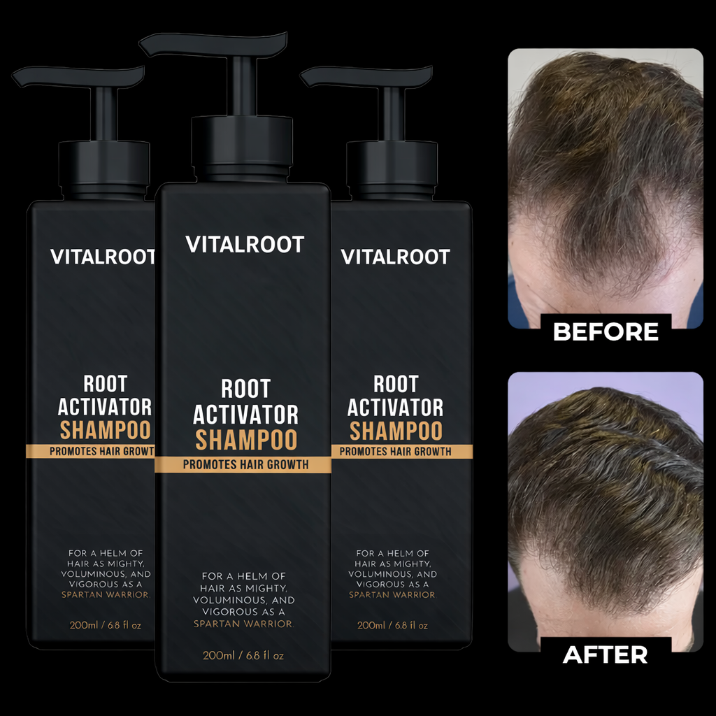 VitalRoot™ Renew & Grow Shampoo