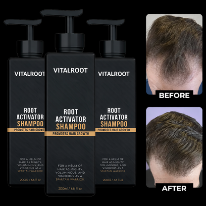 VitalRoot™ Renew & Grow Shampoo