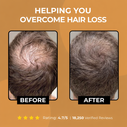 VitalRoot™ Renew & Grow Shampoo