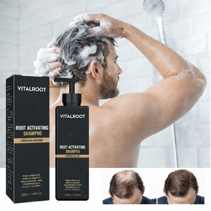 VitalRoot™ Renew & Grow Shampoo